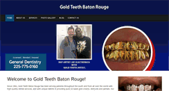 Desktop Screenshot of goldteethbatonrouge.com