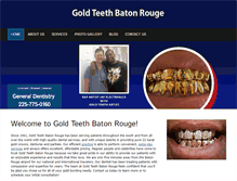 Tablet Screenshot of goldteethbatonrouge.com